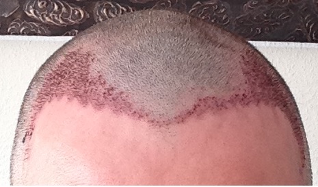 index.php/fa/16124/0/