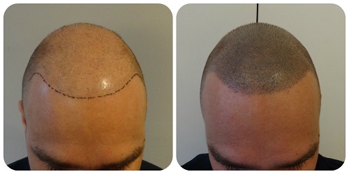 index.php/fa/16209/0/