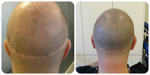 index.php/fa/16210/0/