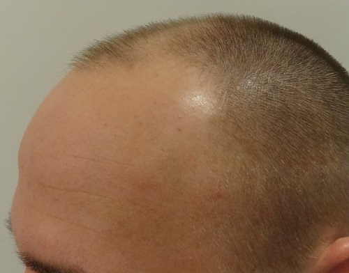 index.php/fa/16217/0/