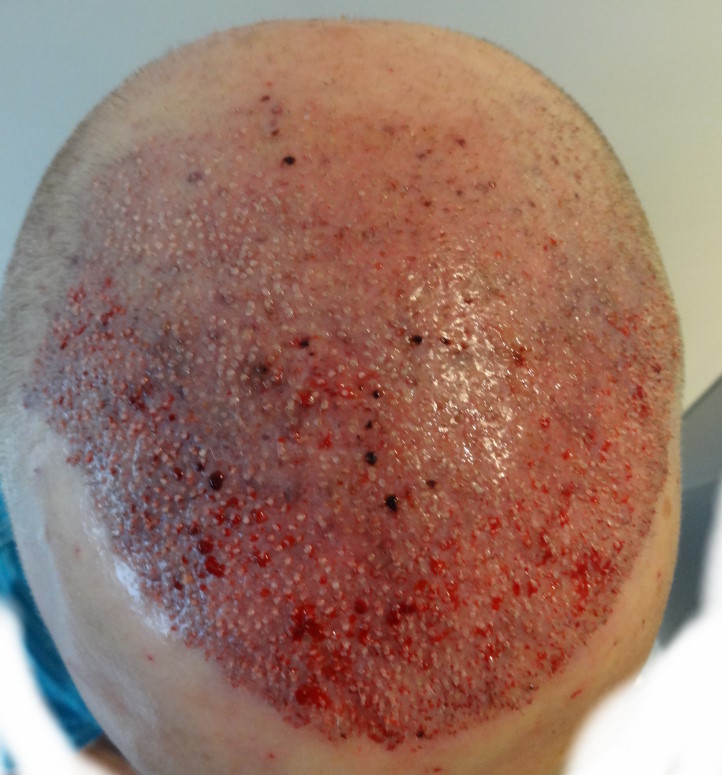 index.php/fa/16291/0/