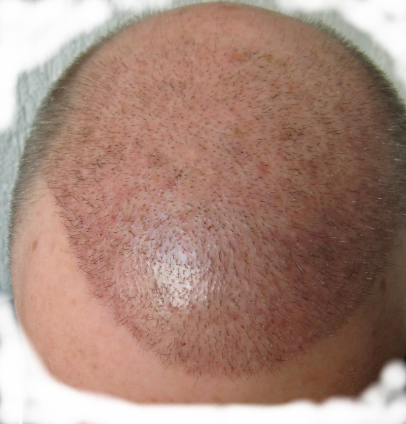 index.php/fa/16292/0/