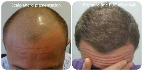 index.php/fa/16357/0/