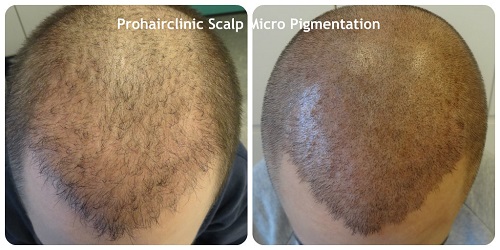 index.php/fa/16358/0/