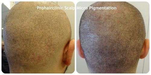 index.php/fa/16359/0/