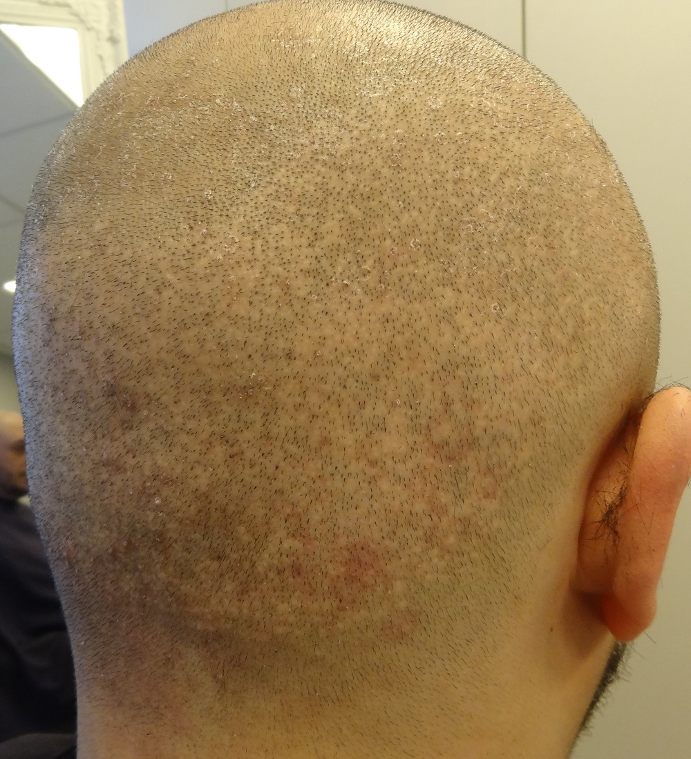 index.php/fa/16360/0/