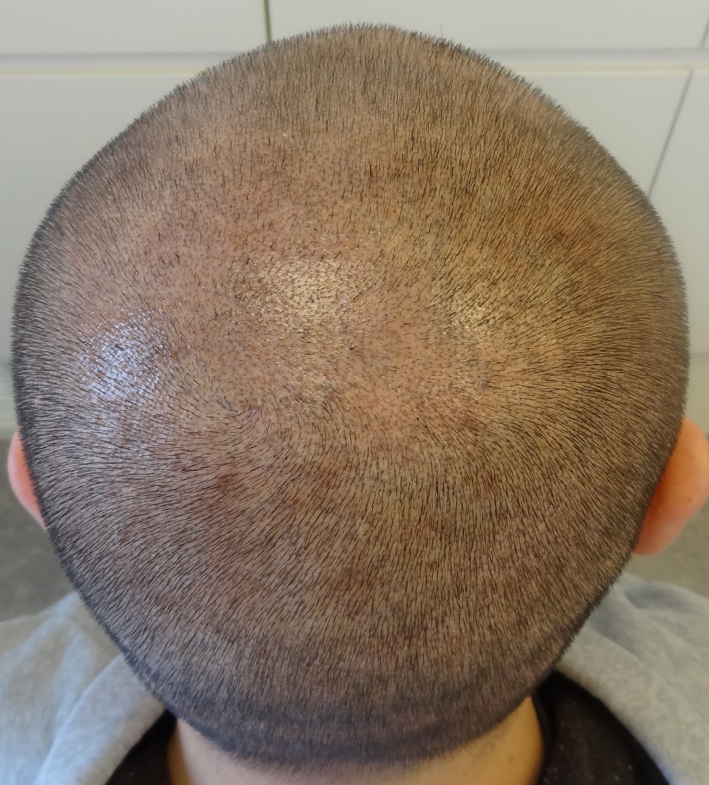 index.php/fa/16382/0/