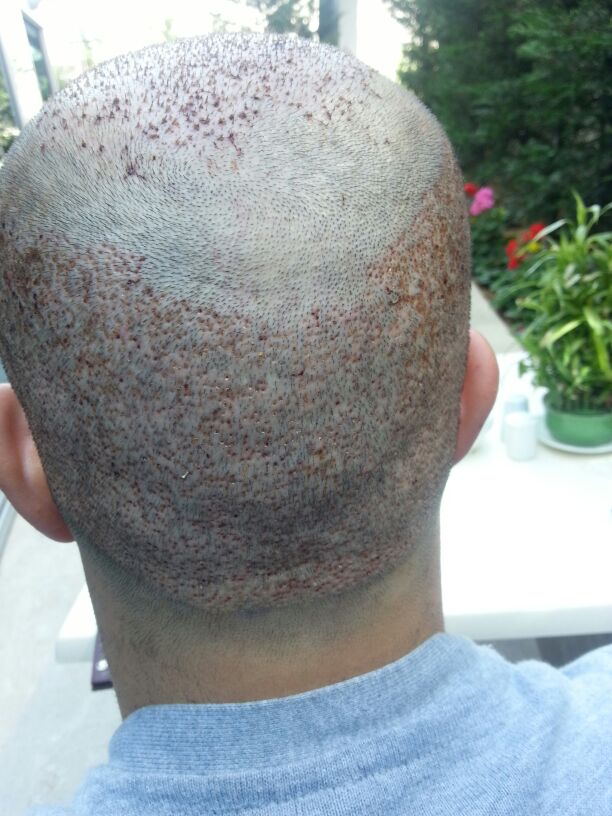 index.php/fa/16451/0/