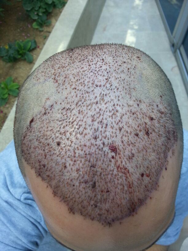 index.php/fa/16453/0/