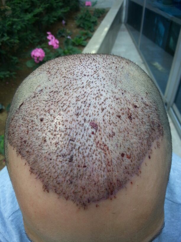 index.php/fa/16454/0/