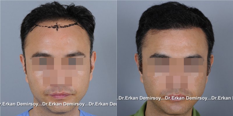 index.php/fa/16455/0/