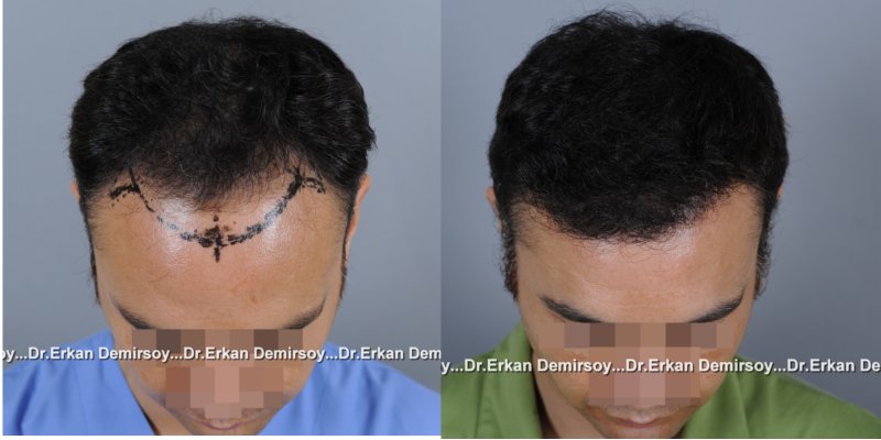 index.php/fa/16456/0/