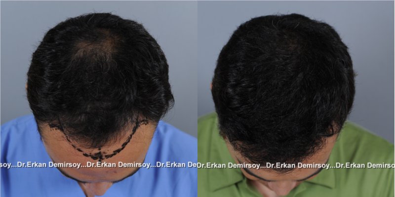 index.php/fa/16457/0/