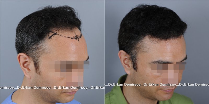 index.php/fa/16460/0/