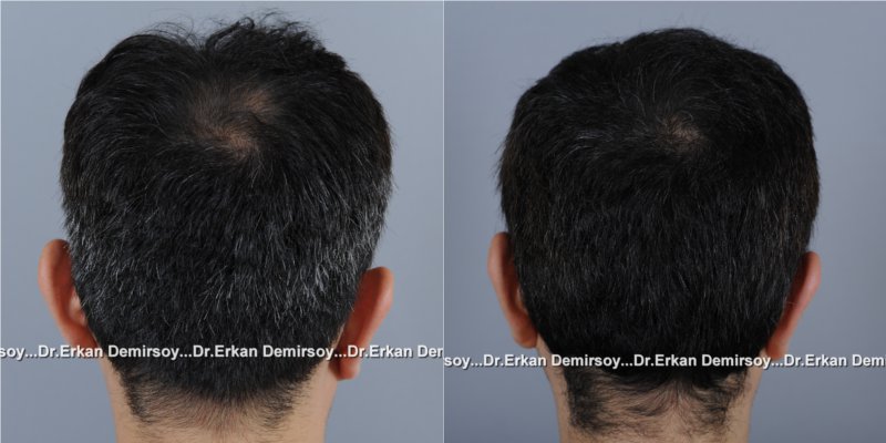 index.php/fa/16462/0/