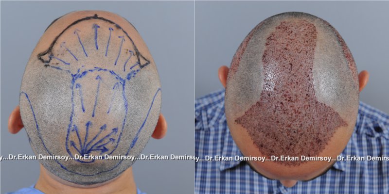 index.php/fa/16464/0/