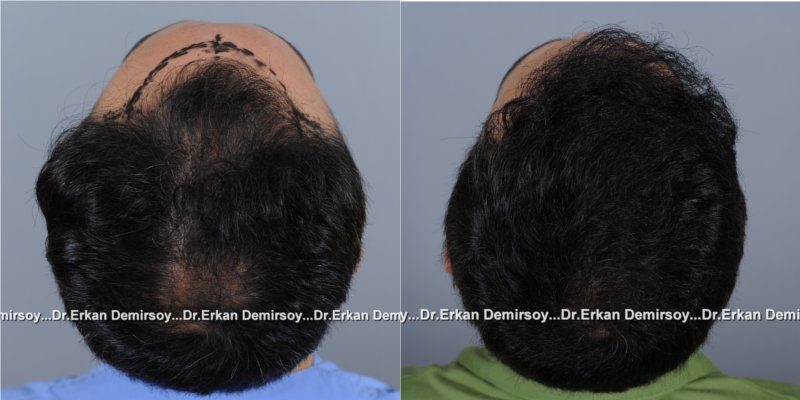 index.php/fa/16465/0/