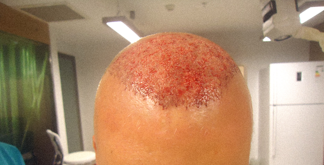 index.php/fa/16644/0/