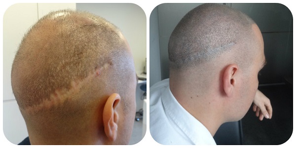 index.php/fa/16670/0/