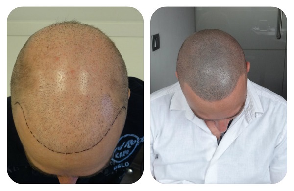 index.php/fa/16671/0/