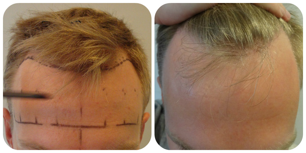 index.php/fa/17086/0/