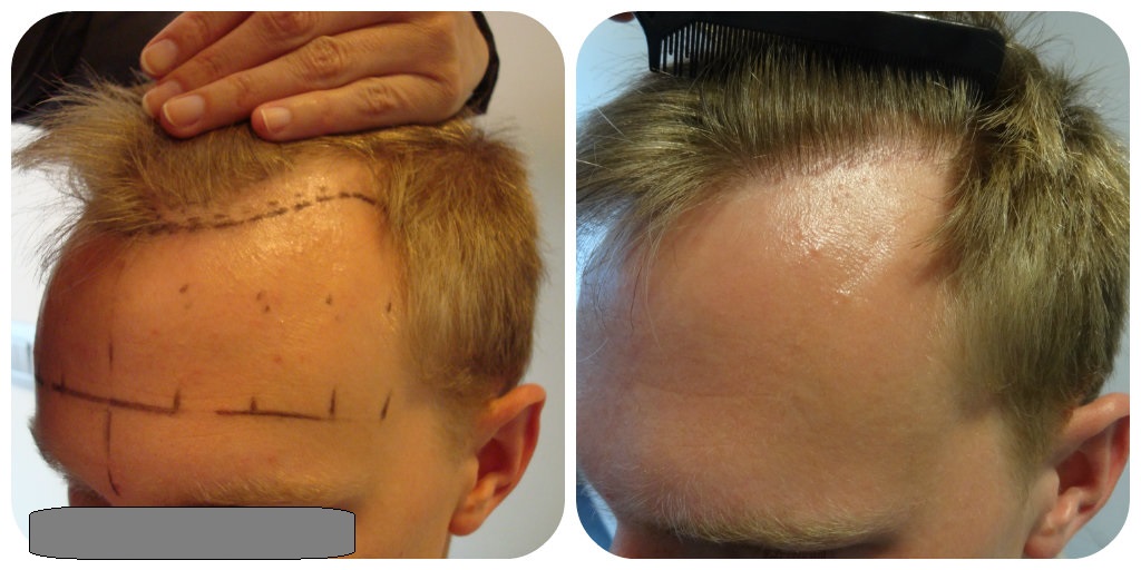 index.php/fa/17087/0/