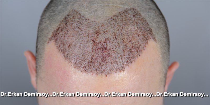 index.php/fa/17236/0/