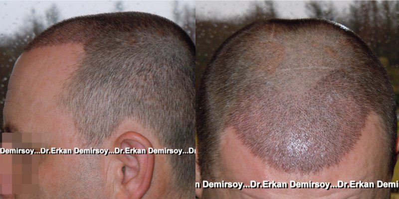 index.php/fa/17238/0/