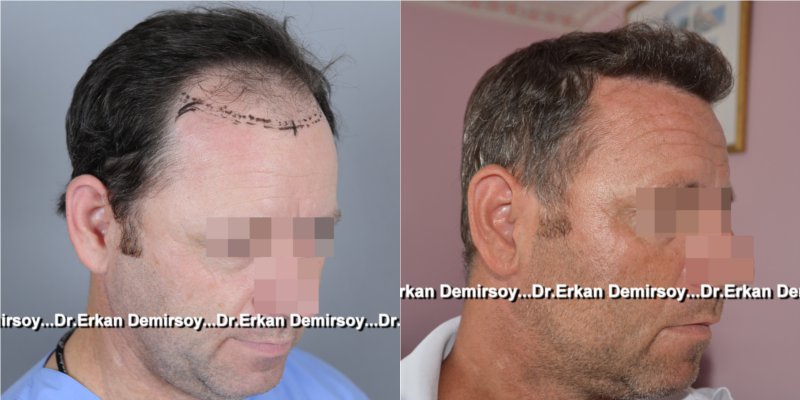 index.php/fa/17241/0/