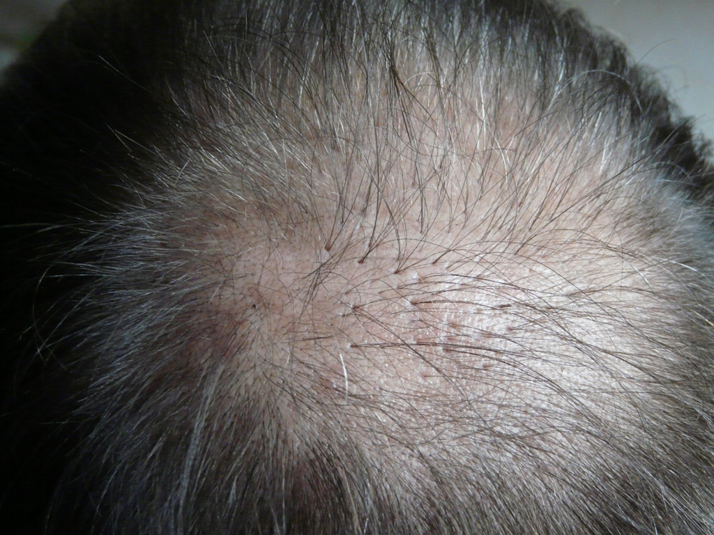 index.php/fa/17273/0/