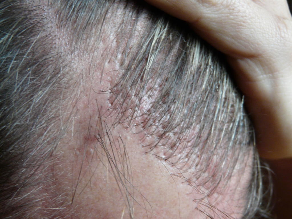 index.php/fa/17274/0/