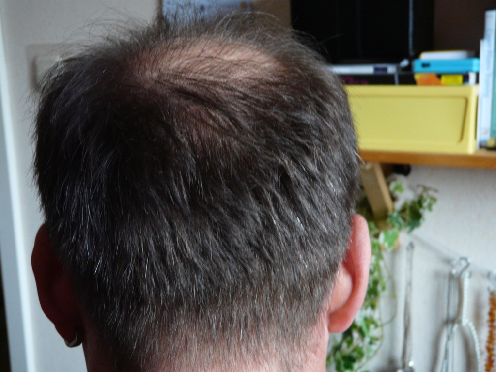 index.php/fa/17278/0/