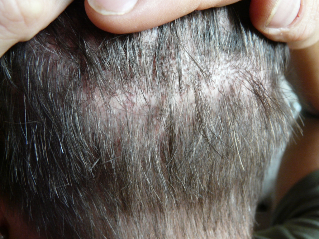 index.php/fa/17279/0/