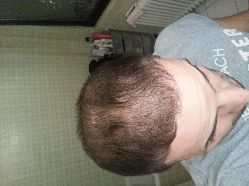 index.php/fa/17369/0/