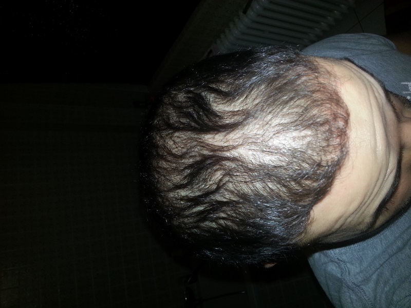 index.php/fa/17376/0/