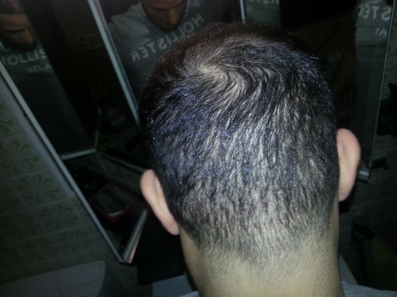 index.php/fa/17379/0/