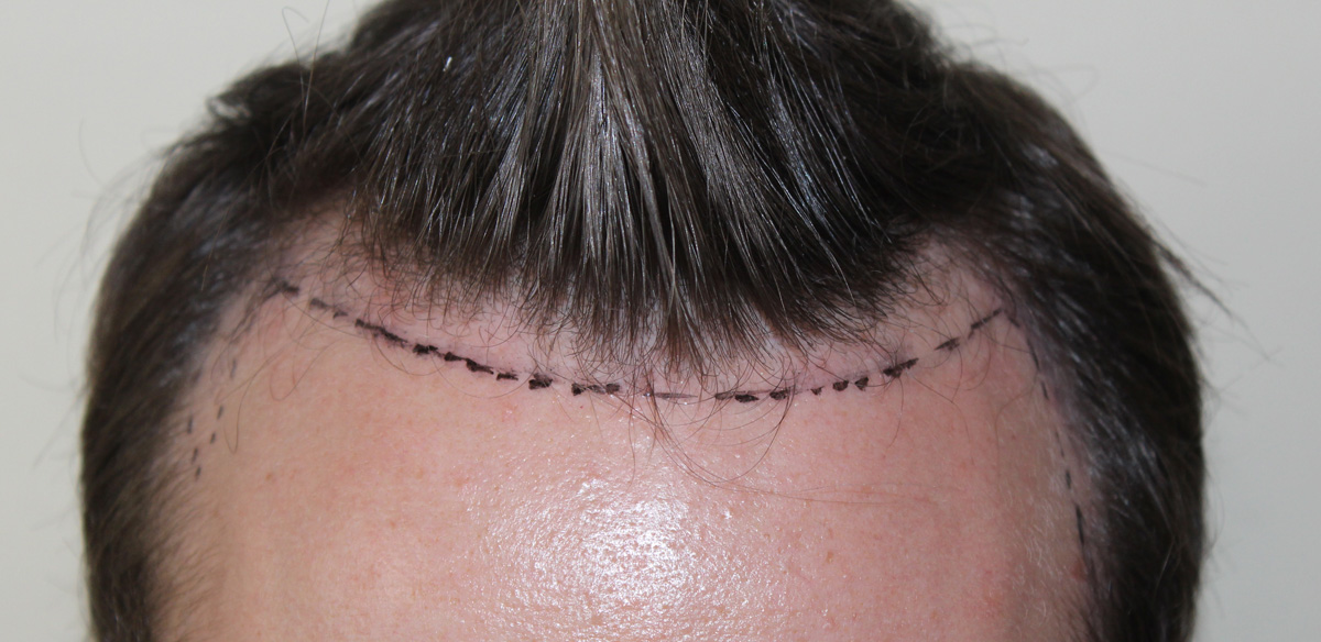 index.php/fa/17424/0/