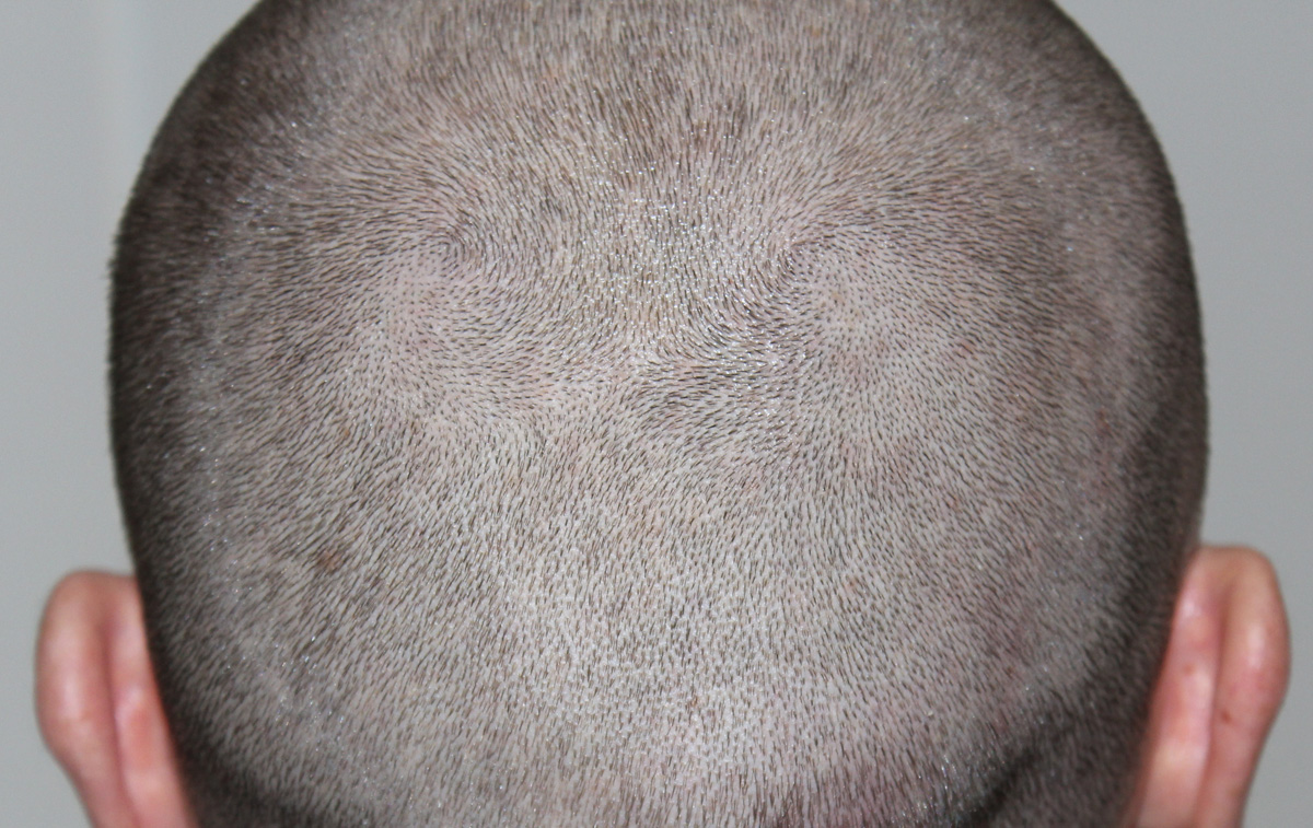 index.php/fa/17428/0/