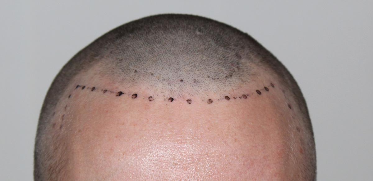 index.php/fa/17430/0/