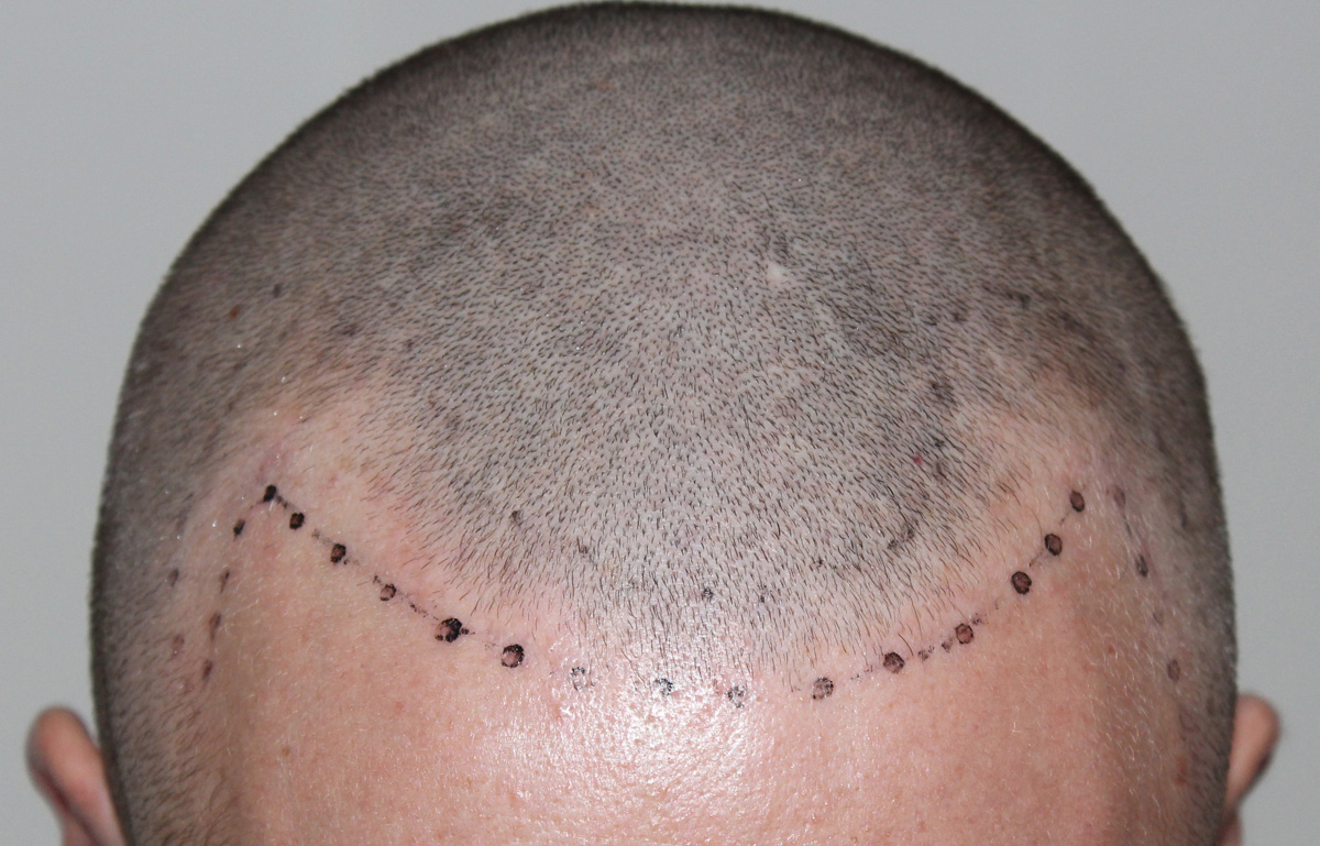 index.php/fa/17431/0/