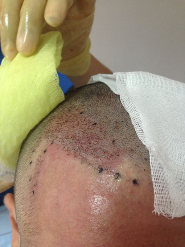 index.php/fa/17439/0/