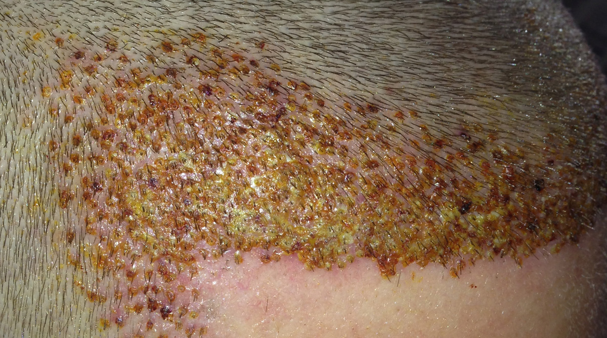 index.php/fa/17442/0/