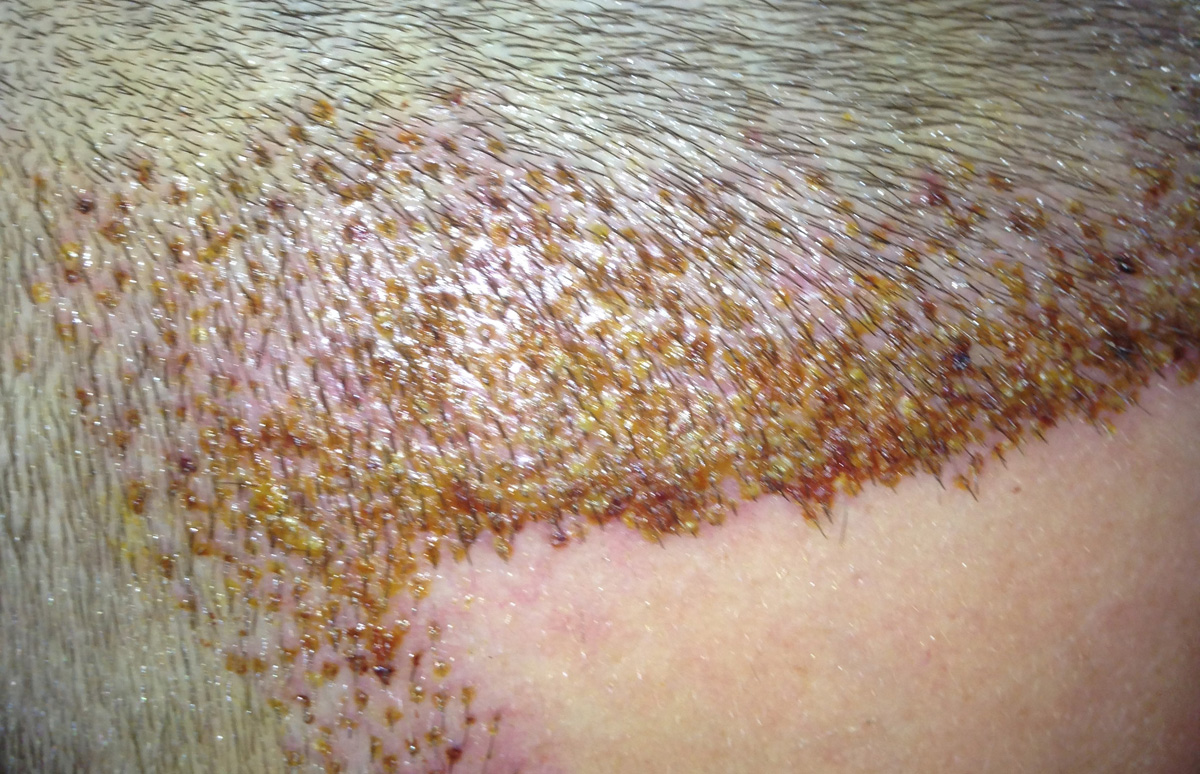 index.php/fa/17443/0/