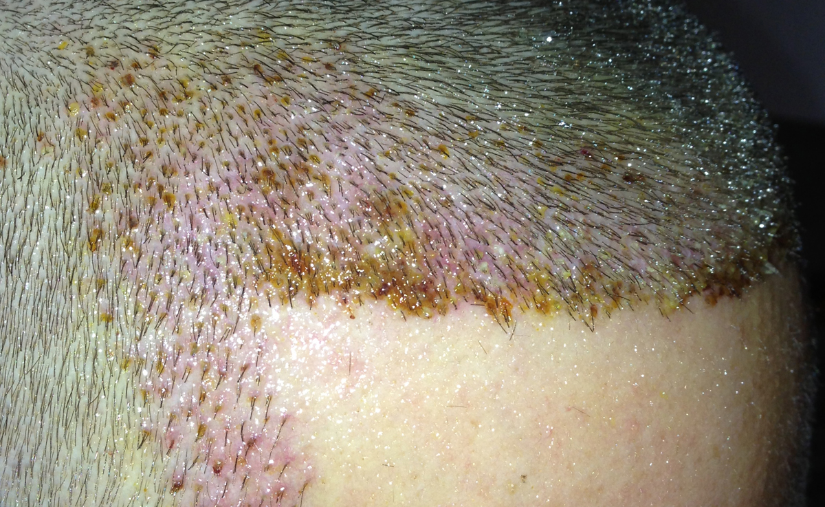 index.php/fa/17444/0/