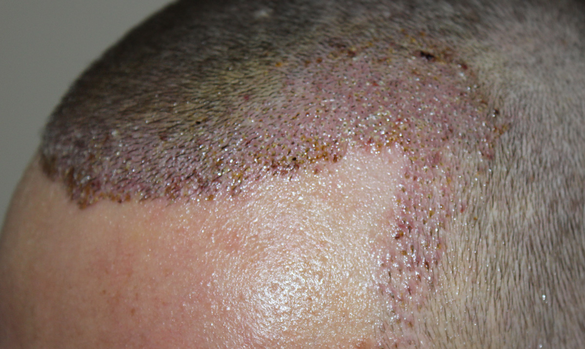 index.php/fa/17445/0/