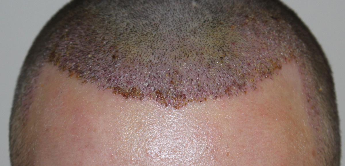 index.php/fa/17447/0/