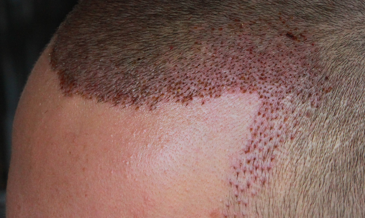 index.php/fa/17452/0/