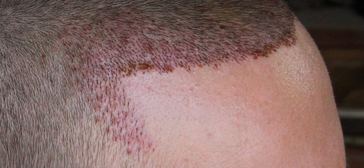 index.php/fa/17453/0/