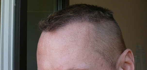 index.php/fa/17509/0/