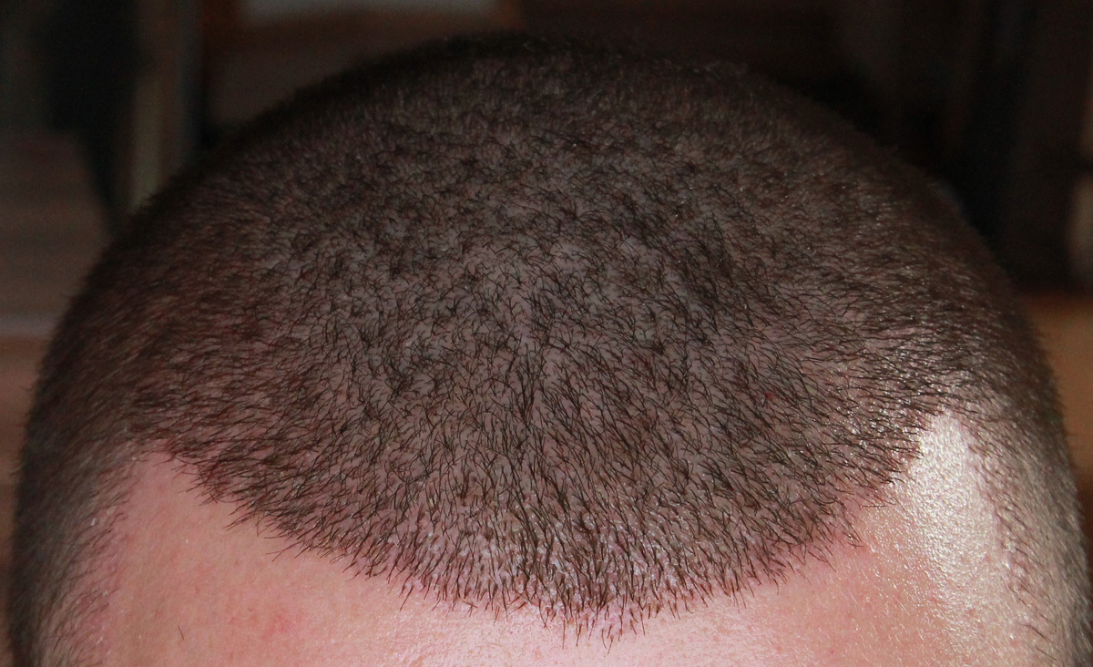 index.php/fa/17558/0/